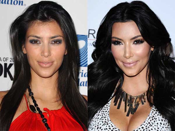 Гоо сайхны хагалгаагаараа дэлхийд тэргүүлэгч орнууд